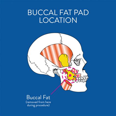 volume of buccal fat pad